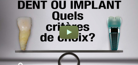 Replay Journée « Secteur antérieur : dent ou implant »